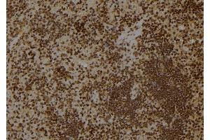 ABIN6275491 at 1/100 staining Rat spleen tissue by IHC-P. (ARHGAP18 抗体  (Internal Region))