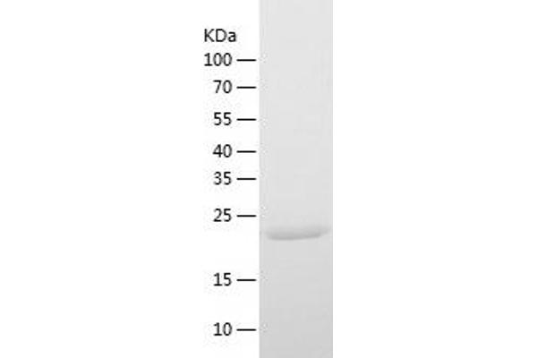 FAHD1 Protein (AA 1-224) (His tag)