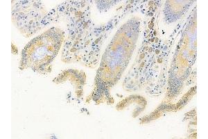ABIN6265529 and ABIN6278643 at 1/100 staining human normal colon tissue by IHC-P.