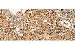Immunohistochemistry (Paraffin-embedded Sections) (IHC (p)) image for anti-ATP Synthase, H+ Transporting, Mitochondrial F0 Complex, Subunit E (ATP5I) antibody (ABIN7245119)