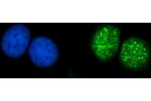 IF analysis of ATRIP using anti-ATRIP antibody (ABIN7599701). (ATRIP 抗体  (AA 109-782))