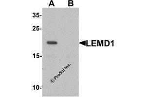 Western Blotting (WB) image for anti-LEM Domain Containing 1 (LEMD1) (Middle Region) antibody (ABIN1030979) (LEMD1 抗体  (Middle Region))