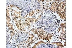 IHC analysis of SAE2/UBA2 using anti-SAE2/UBA2 antibody (ABIN7601755). (UBA2 抗体  (AA 449-564))