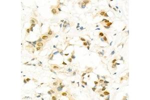 Immunohistochemistry (Paraffin-embedded Sections) (IHC (p)) image for anti-SIX Homeobox 1 (SIX1) antibody (ABIN7075617)