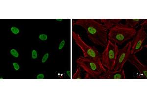 Immunofluorescence (IF) image for anti-Excision Repair Cross-Complementing Rodent Repair Deficiency, Complementation Group 6 (ERCC6) (Internal Region) antibody (ABIN2855858)