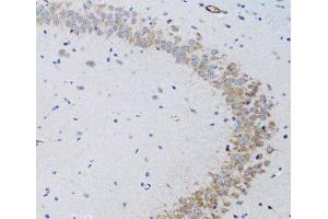 Immunohistochemistry of paraffin-embedded Rat brain using TNFSF12 Polyclonal Antibody at dilution of 1:100 (20x lens). (TWEAK 抗体)