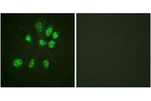 Immunofluorescence analysis of HeLa cells, using Estrogen Receptor-beta (Ab-105) Antibody. (ESR2 抗体  (AA 71-120))