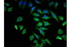 Immunofluorescence staining of A549 cells with ABIN7175266 at 1:133, counter-stained with DAPI. (ATP6V1G2 抗体  (AA 1-118))