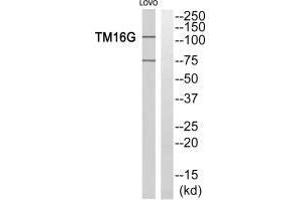 Western blot analysis of extracts from LOVO cells, using TM16G antiobdy. (Anoctamin 7 抗体  (C-Term))