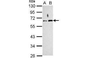 WB Image Sample (30 ug of whole cell lysate) A: Jurkat B: K562 10% SDS PAGE antibody diluted at 1:1000