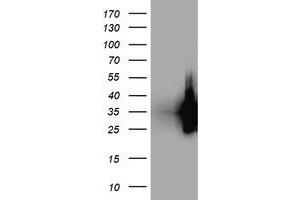 Western Blotting (WB) image for anti-Low Density Lipoprotein Receptor Adaptor Protein 1 (LDLRAP1) antibody (ABIN1496687) (LDLRAP1 抗体)