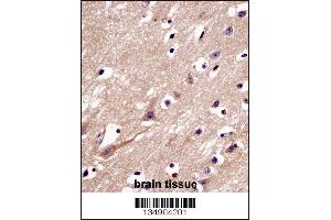 Immunohistochemistry (IHC) image for anti-Chromosome 4 Open Reading Frame 49 (C4orf49) (AA 176-204), (C-Term) antibody (ABIN5537254)