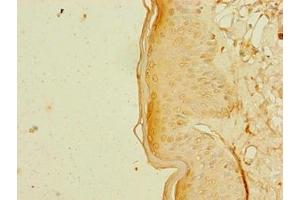 Immunohistochemistry of paraffin-embedded human skin tissue using ABIN7168349 at dilution of 1:100 (RBM41 抗体  (AA 1-413))