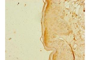Immunohistochemistry of paraffin-embedded human skin tissue using ABIN7168349 at dilution of 1:100
