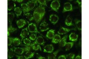 Immunostaining of HeLa cells with the anti-mitochondria antibody. (Mitochondria 抗体)