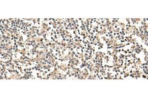 Immunohistochemistry of paraffin-embedded Human tonsil tissue using MAGEA1 Polyclonal Antibody at dilution of 1:65(x200) (MAGEA1 抗体)