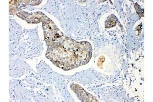 Immunohistochemistry (IHC) image for anti-Periplakin (PPL) (AA 1664-1701) antibody (ABIN5647242)