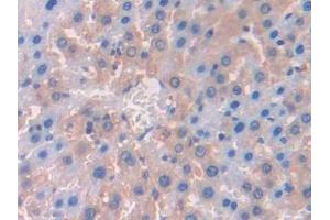 Immunohistochemistry (IHC) image for anti-Lecithin-Cholesterol Acyltransferase (LCAT) (AA 41-210) antibody (ABIN7436696)