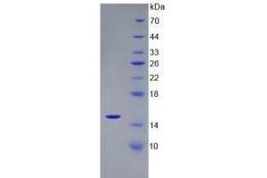 SDS-PAGE of Protein Standard from the Kit (Highly purified E. (CST3 ELISA 试剂盒)