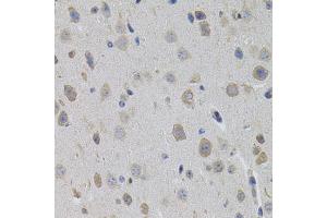 Immunohistochemistry of paraffin-embedded mouse brain using SUMO3 antibody (ABIN5971585) (40x lens). (SUMO3 抗体)