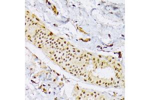 Immunohistochemistry (IHC) image for anti-serine/arginine-Rich Splicing Factor 3 (SRSF3) (AA 1-90) antibody (ABIN6148465)