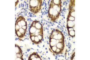 Immunohistochemistry of paraffin-embedded human colon using GIPC2 antibody (ABIN5970567) at dilution of 1/100 (40x lens). (GIPC2 抗体)
