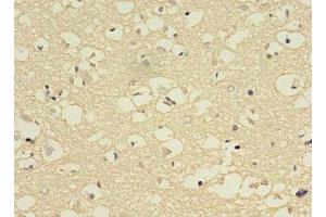 Immunohistochemistry of paraffin-embedded human brain tissue using ABIN7149247 at dilution of 1:100 (CYP2E1 抗体  (AA 49-288))