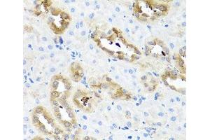 Immunohistochemistry of paraffin-embedded Rat kidney using FABP5 Polyclonal Antibody at dilution of 1:100 (40x lens). (FABP5 抗体)