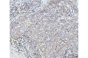 IHC analysis of Golgin 97/GOLGA1 using anti-Golgin 97/GOLGA1 antibody (ABIN7599539).