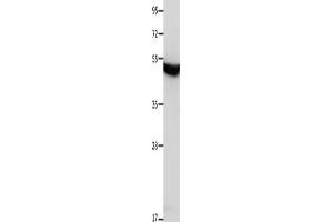 Gel: 10 % SDS-PAGE, Lysate: 30 μg, Lane: Mouse brain tissue, Primary antibody: ABIN7191529(MTNR1A Antibody) at dilution 1/650, Secondary antibody: Goat anti rabbit IgG at 1/8000 dilution, Exposure time: 1 minute (Melatonin Receptor 1A 抗体)
