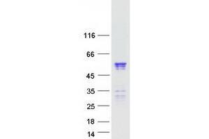 Western Blotting (WB) image for Nucleoporin 50kDa (NUP50) (Transcript Variant 3) protein (Myc-DYKDDDDK Tag) (ABIN2727821)