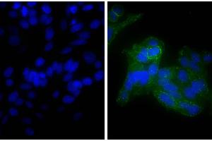 Human epithelial carcinoma cell line HEp-2 was stained with Mouse Anti-Human CD44-UNLB, and DAPI. (山羊 anti-小鼠 Ig (Heavy & Light Chain) Antibody (Biotin))