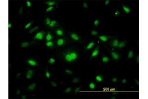 Immunofluorescence of monoclonal antibody to RNF12 on HeLa cell.