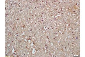 Formalin-fixed and paraffin embedded rat brain labeled with Rabbit Anti-IKK gamma (Ser376) Polyclonal Antibody, Unconjugated  at 1:200 followed by conjugation to the secondary antibody and DAB staining (IKBKG 抗体  (pSer376))