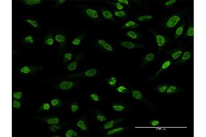 Immunofluorescence of purified MaxPab antibody to EWSR1 on HeLa cell. (EWSR1 抗体  (AA 1-656))