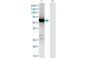 Western Blot analysis of UGT2B7 expression in transfected 293T cell line by UGT2B7 monoclonal antibody (M02), clone 8D12.