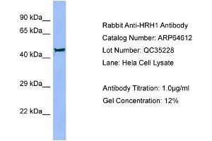 Western Blotting (WB) image for anti-Histamine Receptor H1 (HRH1) (Middle Region) antibody (ABIN2789899) (HRH1 抗体  (Middle Region))