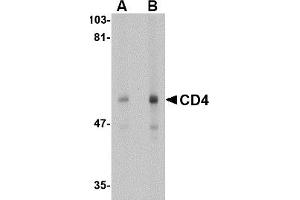 Western Blotting (WB) image for anti-CD4 (CD4) (N-Term) antibody (ABIN492543) (CD4 抗体  (N-Term))