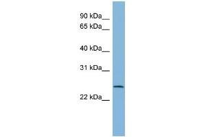 WB Suggested Anti-CXorf26 Antibody Titration: 0. (CXorf26 抗体  (Middle Region))