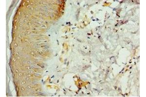 Immunohistochemistry of paraffin-embedded human skin tissue using ABIN7168977 at dilution of 1:100 (STK16 抗体  (AA 1-305))