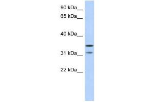 WB Suggested Anti-C17orf81 Antibody Titration: 0. (Retinoic Acid Induced 12 (RAI12) (Middle Region) 抗体)