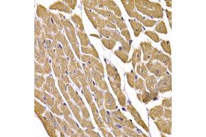Immunohistochemistry of paraffin-embedded mouse heart using SLC2A4 antibody. (GLUT4 抗体  (C-Term))