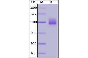 Biotinylated Human ACE2, His,Avitag on SDS-PAGE under reducing (R) condition. (ACE2 Protein (His tag,AVI tag,Biotin))