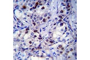 Immunohistochemistry (IHC) image for anti-Retinoblastoma Protein (Rb Protein) (AA 586-615) antibody (ABIN3032465)