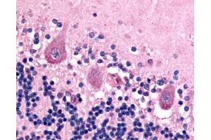 Anti-BAI1 antibody IHC of human brain, neurons. (BAI1 抗体  (C-Term))