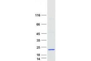 Western Blotting (WB) image for Arachidonate 5-Lipoxygenase-Activating Protein (ALOX5AP) protein (Myc-DYKDDDDK Tag) (ABIN2714586)