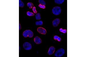 Immunofluorescence (IF) image for anti-Nucleoporin 153kDa (NUP153) (AA 50-100) antibody (ABIN7448391) (NUP153 抗体  (AA 50-100))