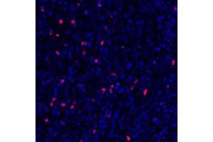 Immunofluorescence (IF) image for anti-Forkhead Box P3 (FOXP3) (AA 275-325) antibody (ABIN7455209)