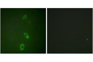Immunofluorescence (IF) image for anti-Potassium Inwardly-Rectifying Channel, Subfamily J, Member 1 (KCNJ1) (AA 11-60) antibody (ABIN2888901) (KCNJ1 抗体  (AA 11-60))