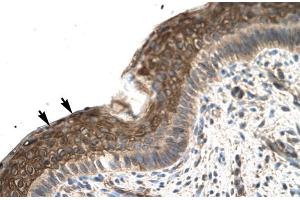 Human Spermatophore; Rabbit Anti-ZFP1 Antibody. (Zfp-1 抗体  (N-Term))